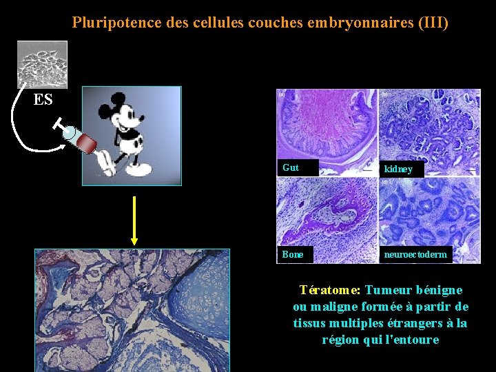 Pluripotence des cellules couches embryonnaires (III) ES Gut kidney Bone neuroectoderm Tératome: Tumeur bénigne