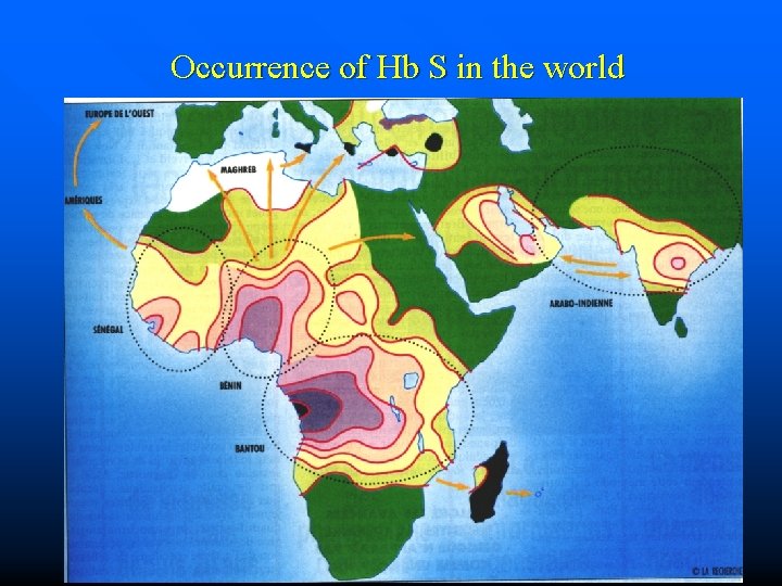 Occurrence of Hb S in the world 26. 9. 2016 gens 20 b 10