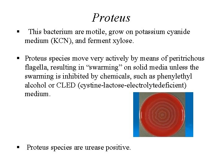 Proteus § This bacterium are motile, grow on potassium cyanide medium (KCN), and ferment