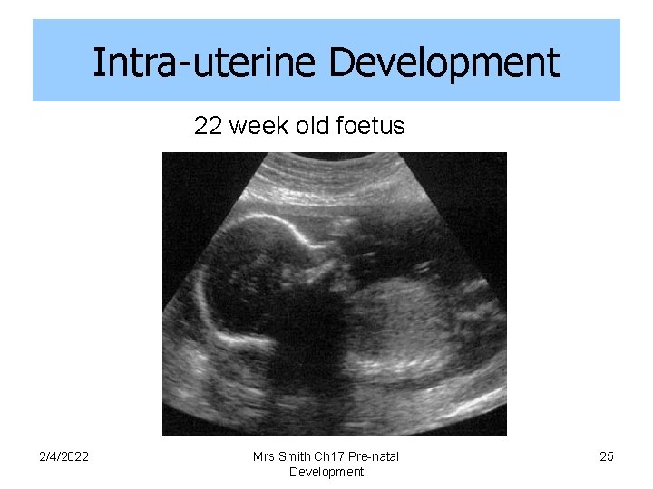 Intra-uterine Development 22 week old foetus 2/4/2022 Mrs Smith Ch 17 Pre-natal Development 25