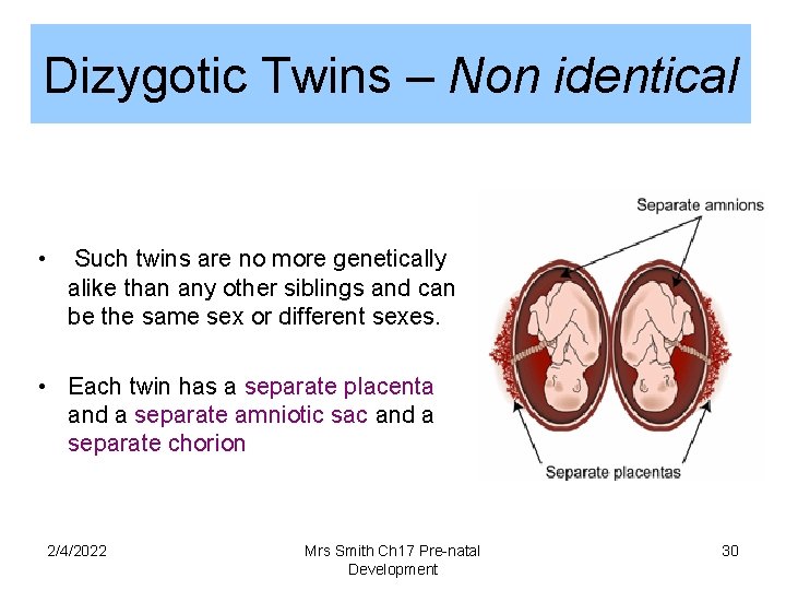 Dizygotic Twins – Non identical • Such twins are no more genetically alike than