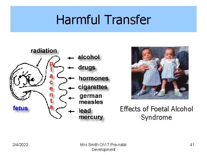 Harmful Transfer Effects of Foetal Alcohol Syndrome 2/4/2022 Mrs Smith Ch 17 Pre-natal Development