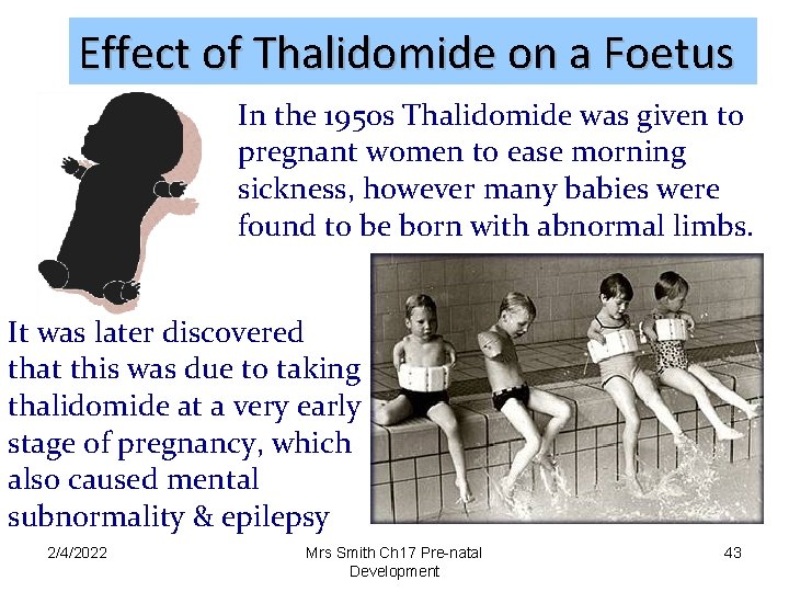 Effect of Thalidomide on a Foetus In the 1950 s Thalidomide was given to