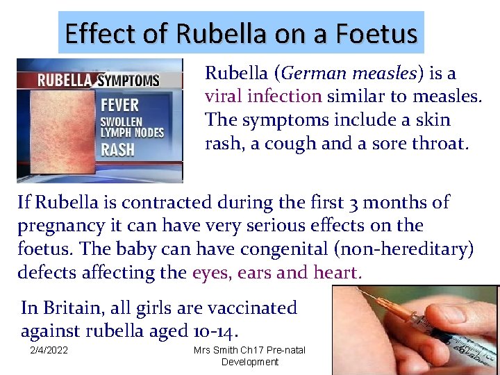 Effect of Rubella on a Foetus Rubella (German measles) is a viral infection similar