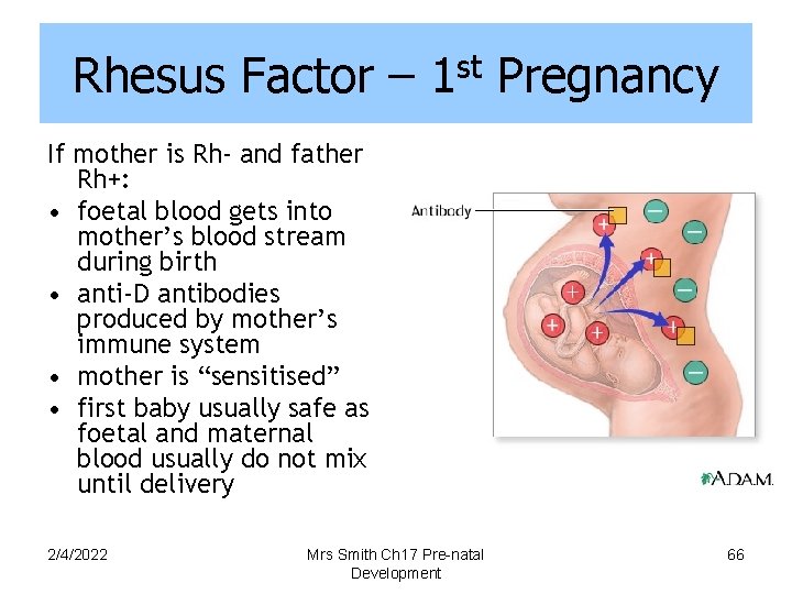 Rhesus Factor – 1 st Pregnancy If mother is Rh- and father Rh+: •