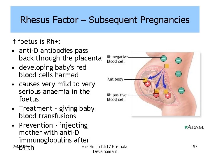 Rhesus Factor – Subsequent Pregnancies If foetus is Rh+: • anti-D antibodies pass back