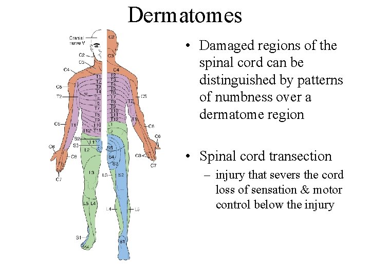 Dermatomes • Damaged regions of the spinal cord can be distinguished by patterns of