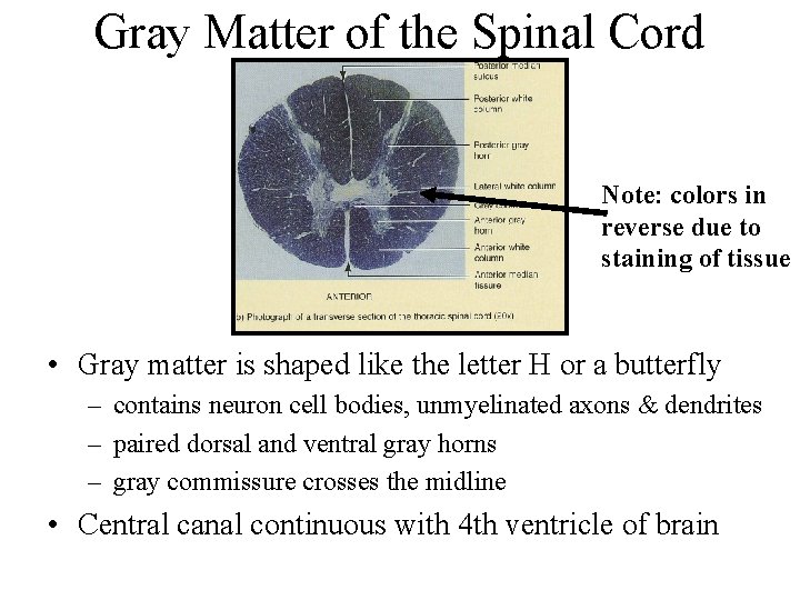 Gray Matter of the Spinal Cord Note: colors in reverse due to staining of