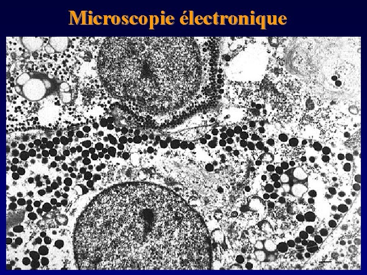 Microscopie électronique 