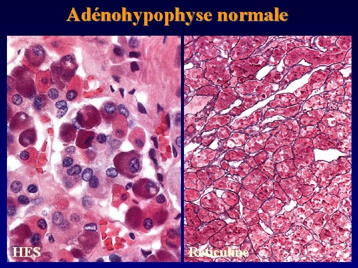 Adénohypophyse normale HES Réticuline 