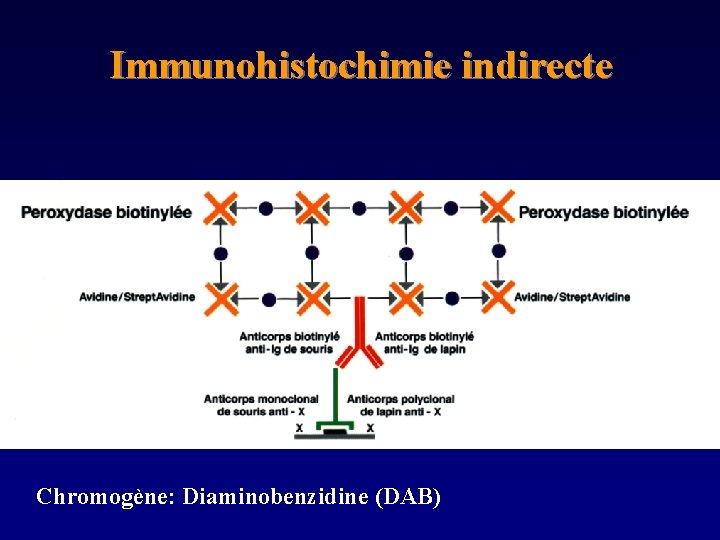 Immunohistochimie indirecte Chromogène: Diaminobenzidine (DAB) 