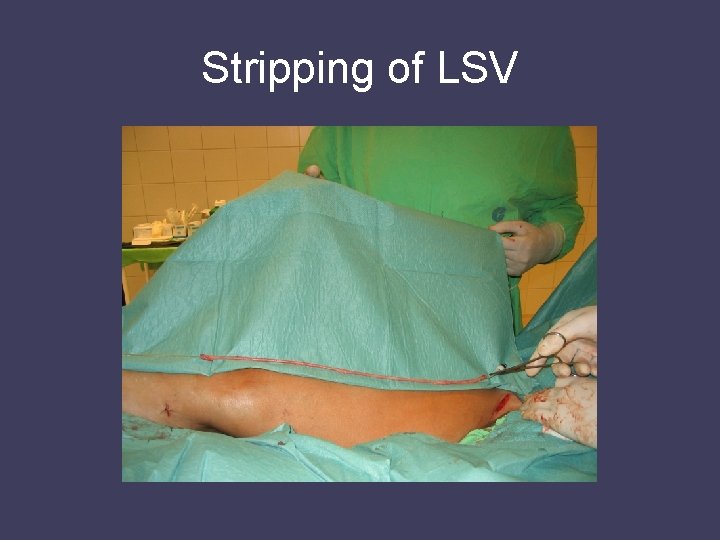 Stripping of LSV 