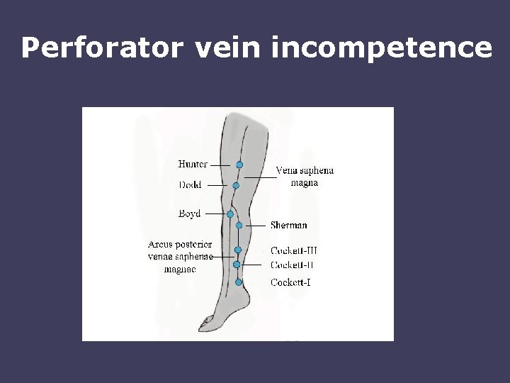 Perforator vein incompetence 