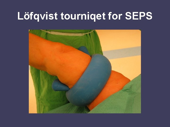 Löfqvist tourniqet for SEPS 