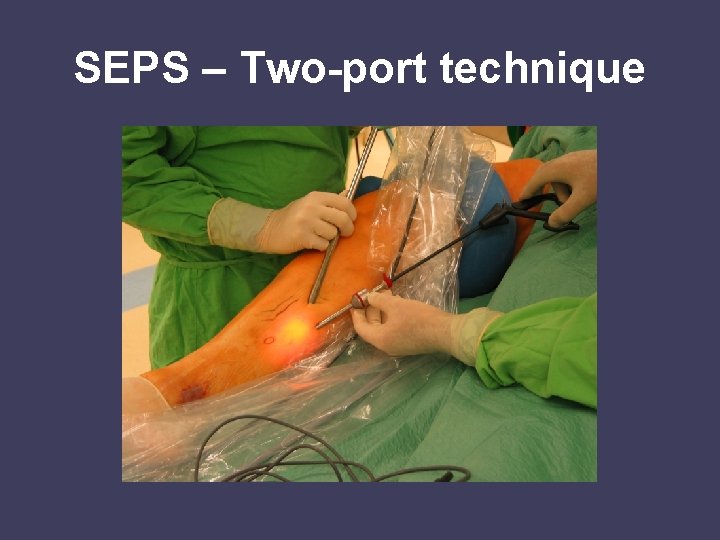SEPS – Two-port technique 