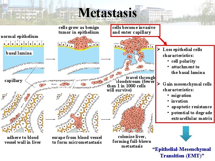 Metastasis normal epithelium cells grow as benign tumor in epithelium cells become invasive and