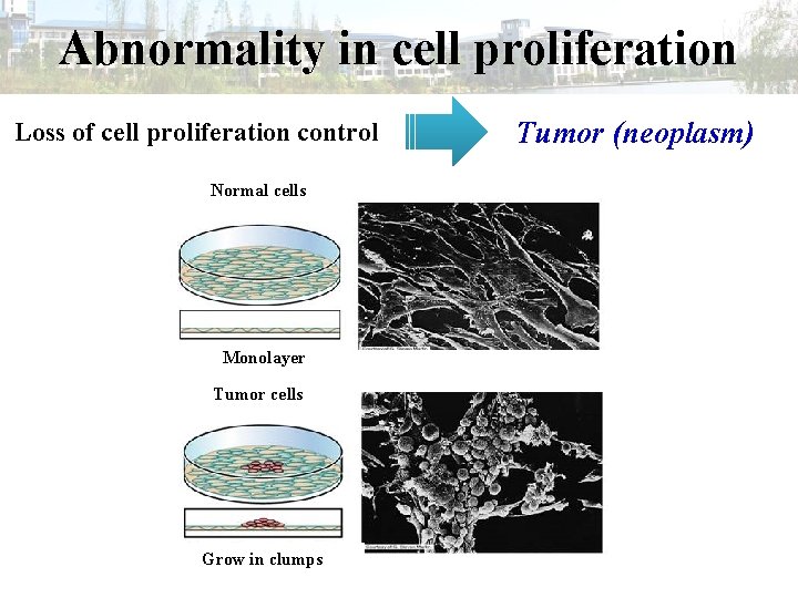 Abnormality in cell proliferation Loss of cell proliferation control Normal cells Monolayer Tumor cells