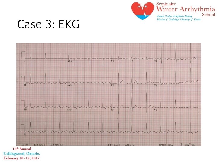Case 3: EKG 