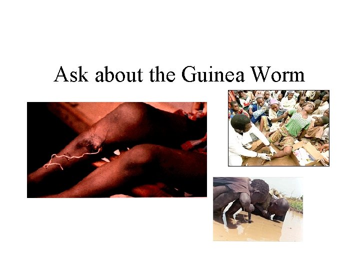 Ask about the Guinea Worm 