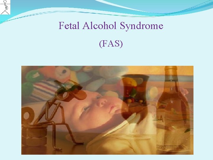 Fetal Alcohol Syndrome (FAS) 