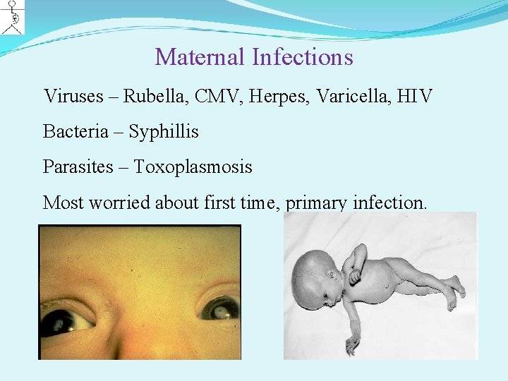 Maternal Infections Viruses – Rubella, CMV, Herpes, Varicella, HIV Bacteria – Syphillis Parasites –