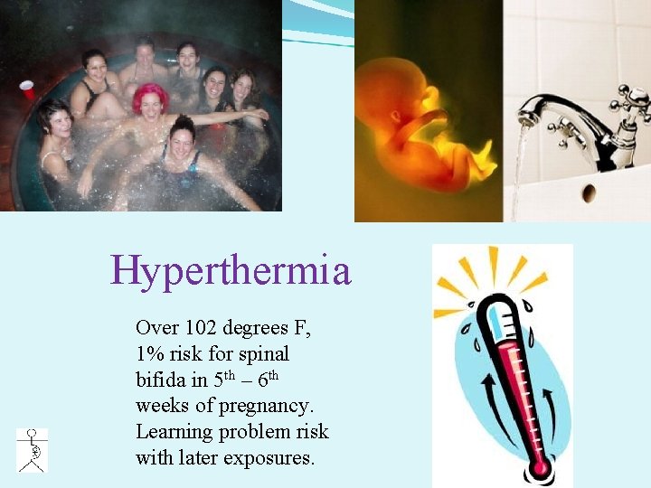 Hyperthermia Over 102 degrees F, 1% risk for spinal bifida in 5 th –