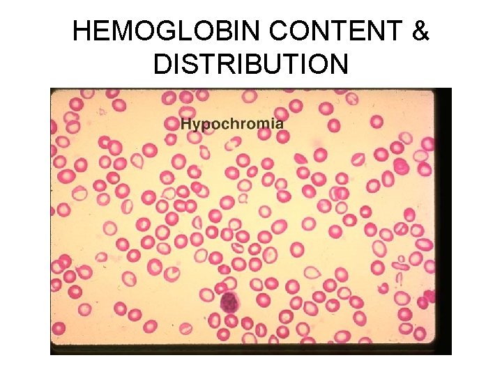 HEMOGLOBIN CONTENT & DISTRIBUTION 