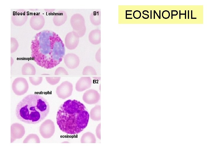 EOSINOPHIL 