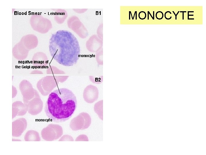 MONOCYTE 