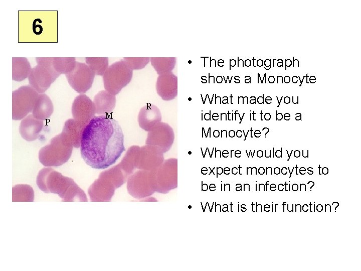 6 • The photograph shows a Monocyte • What made you identify it to
