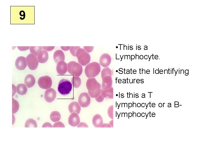 9 • This is a Lymphocyte. • State the Identifying features • Is this