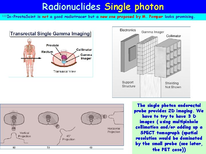 Radionuclides Single photon 111 In-Prosta. Scint is not a good radiotracer but a new