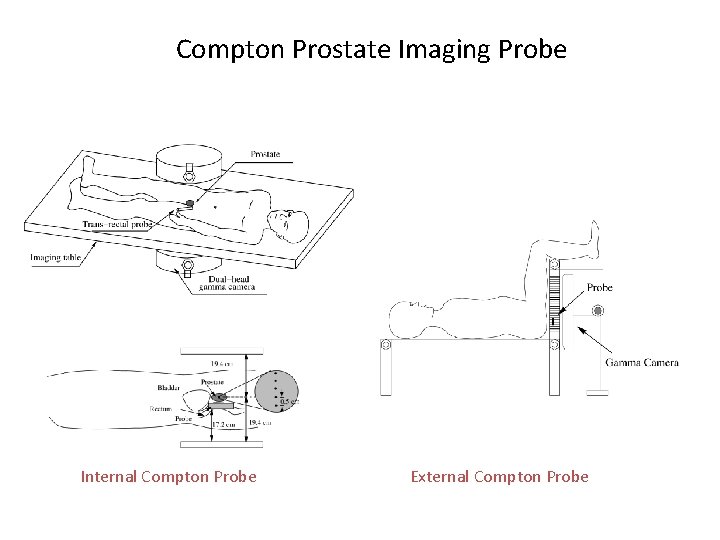 Compton Prostate Imaging Probe Internal Compton Probe External Compton Probe 