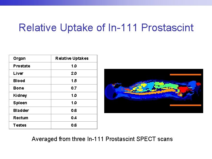 Relative Uptake of In-111 Prostascint Organ Relative Uptakes Prostate 1. 0 Liver 2. 0