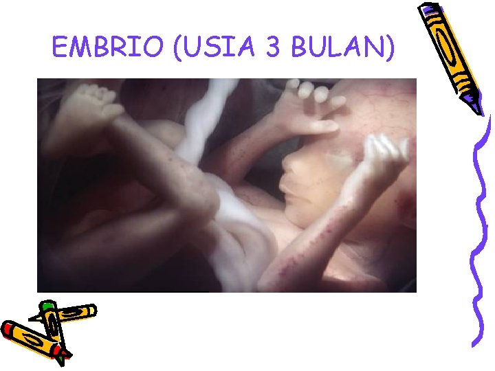 EMBRIO (USIA 3 BULAN) 