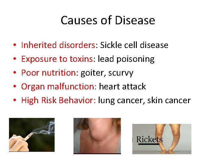 Causes of Disease • • • Inherited disorders: Sickle cell disease Exposure to toxins: