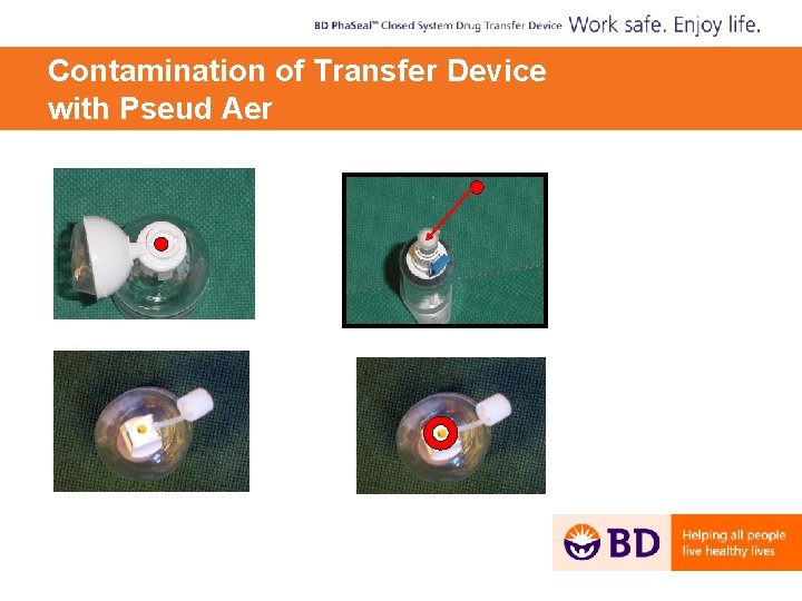 Contamination of Transfer Device with Pseud Aer 