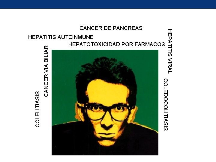 CANCER VIA BILIAR COLEDOCOLITIASIS COLELITIASIS HEPATITIS AUTOINMUNE HEPATOTOXICIDAD POR FARMACOS HEPATITIS VIRAL CANCER DE