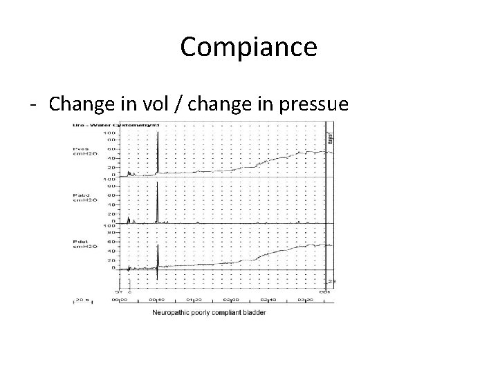 Compiance - Change in vol / change in pressue 