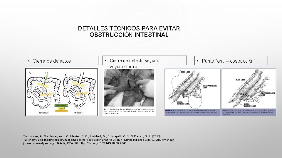 DETALLES TÉCNICOS PARA EVITAR OBSTRUCCIÓN INTESTINAL • Cierre de defectos mesentéricos • Cierre de