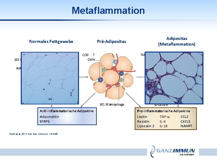 Metaflammation Normales Fettgewebe CD 4+ T-Zelle (Th 2) M 2 Makrophage Prä-Adipositas (Metaflammation) Nekrotischer