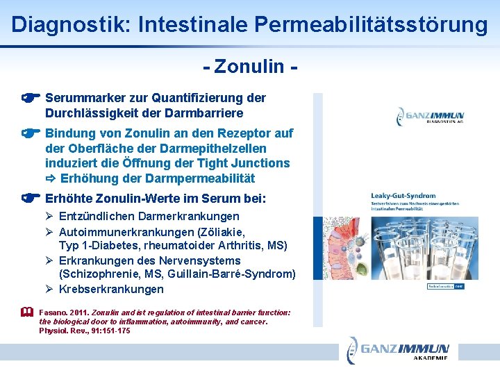 Diagnostik: Intestinale Permeabilitätsstörung - Zonulin zur Quantifizierung der Serummarker Durchlässigkeit der Darmbarriere von Zonulin