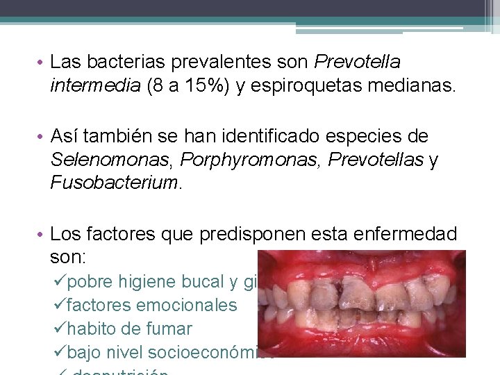  • Las bacterias prevalentes son Prevotella intermedia (8 a 15%) y espiroquetas medianas.