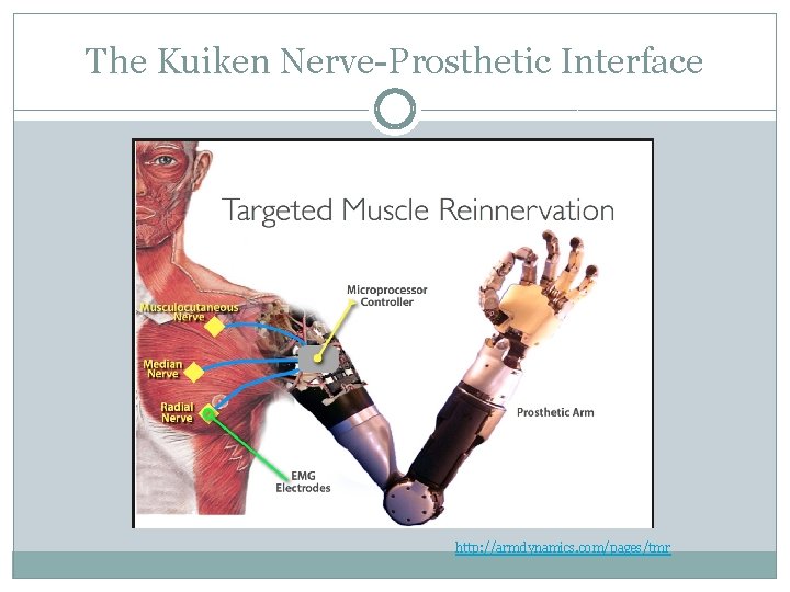 The Kuiken Nerve-Prosthetic Interface http: //armdynamics. com/pages/tmr 
