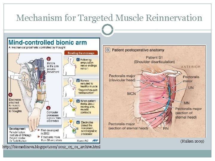 Mechanism for Targeted Muscle Reinnervation (Kuiken 2009) http: //biomedinova. blogspot. com/2012_05_01_archive. html 