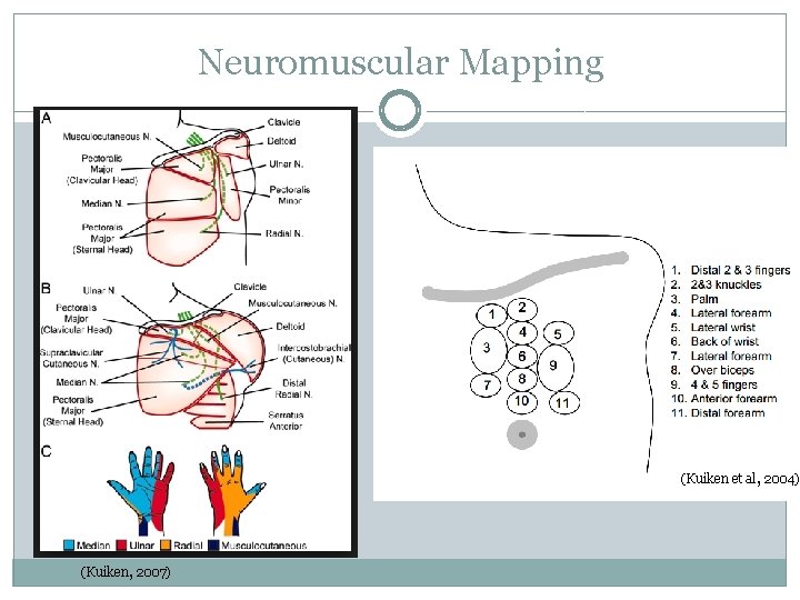 Neuromuscular Mapping (Kuiken et al, 2004) (Kuiken, 2007) 