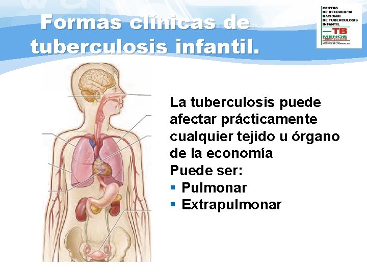 Formas clínicas de tuberculosis infantil. Xxxxxxxx X X X x La tuberculosis puede afectar