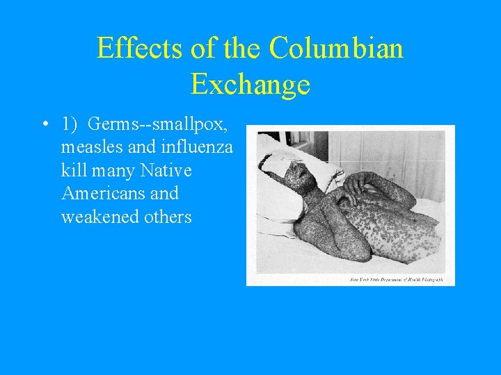 Effects of the Columbian Exchange • 1) Germs--smallpox, measles and influenza kill many Native Effects of the Columbian Exchange • 1) Germs--smallpox, measles and influenza kill many Native