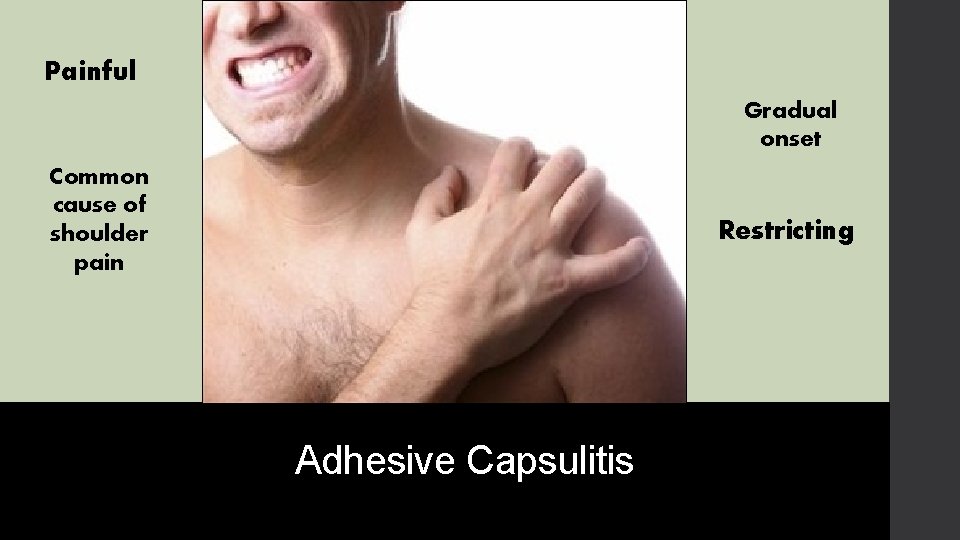 Painful Gradual onset Common cause of shoulder pain Restricting Adhesive Capsulitis 