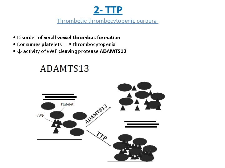 2 - TTP Thrombotic thrombocytopenic purpura • Disorder of small vessel thrombus formation •